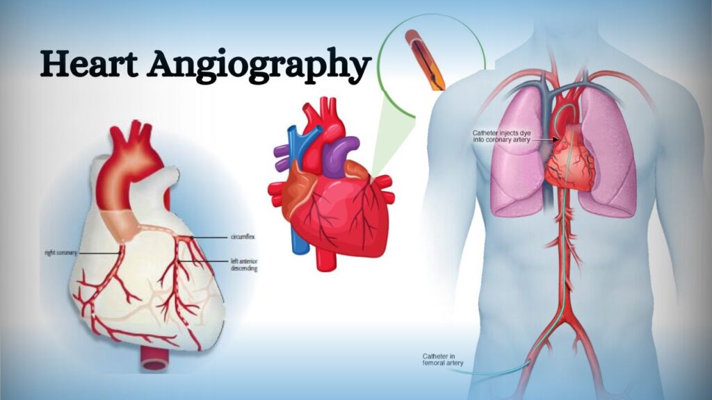 Coronary Angiogram Specialist Dr.Kiran Lakkireddy