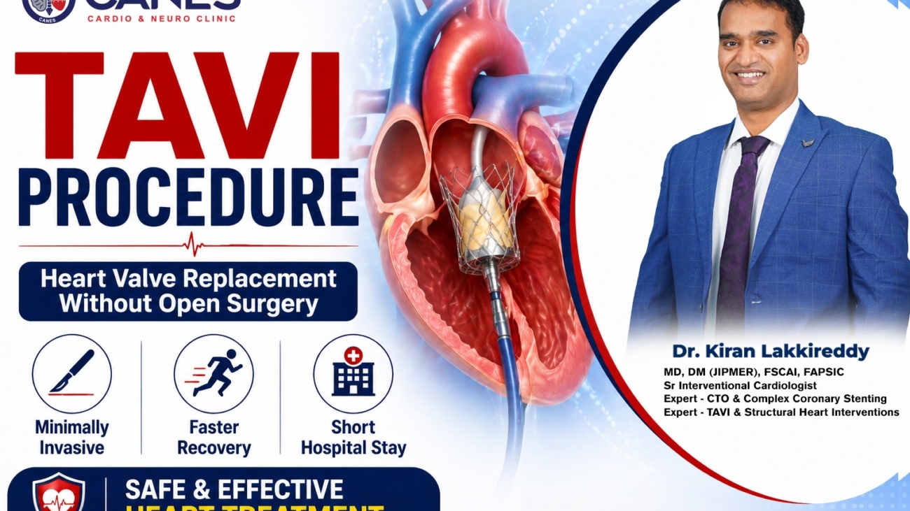 TAVI Procedure | | Dr. Kiran Lakkireddy | Best Cardiologist | Canes clinic