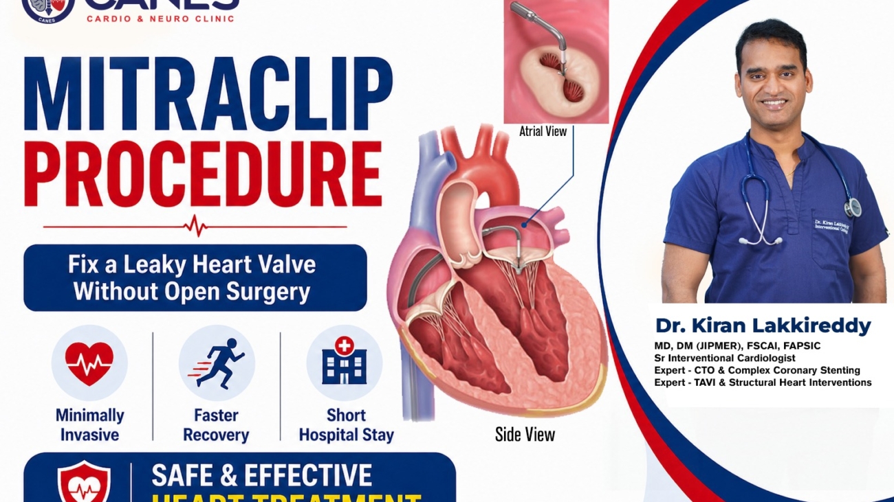 MitraClip Procedure | Dr Kiran Lakkireddy | Best Cardiologist In Hyderabad