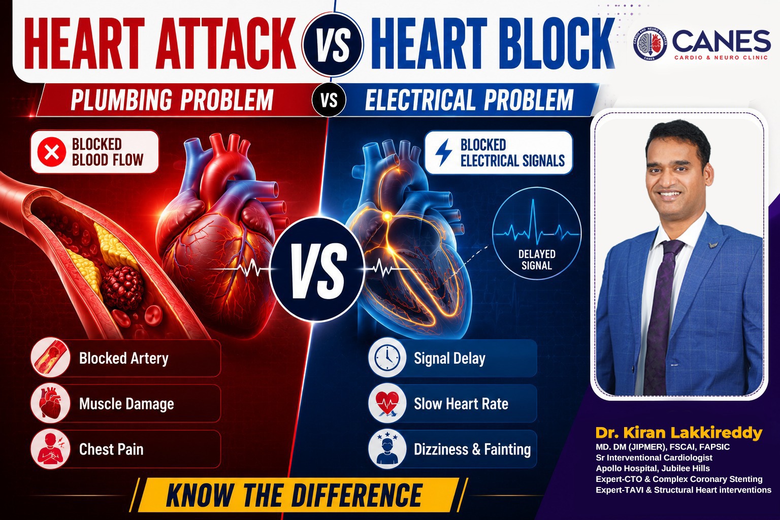 Difference Between a Heart Attack and Heart Block