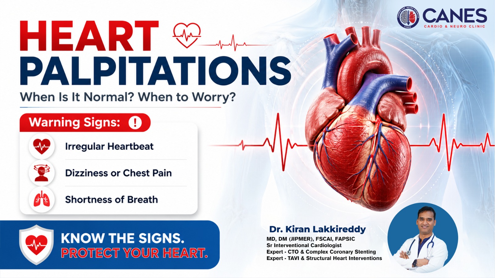 Heart Palpitations - Dr Kiran Lakkireddy - CANES Clinic