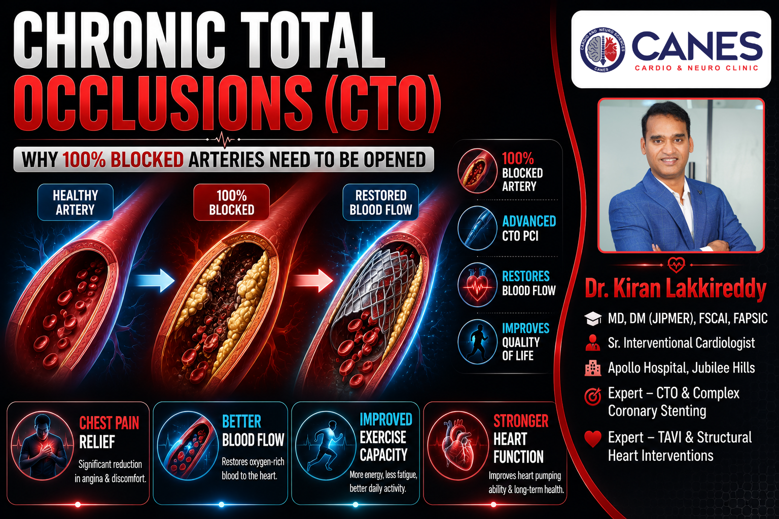 Chronic Total Occlusions