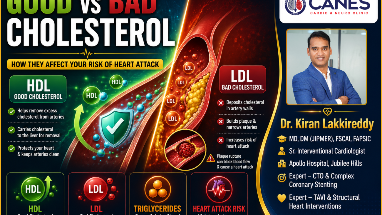 Good and bad cholesterol