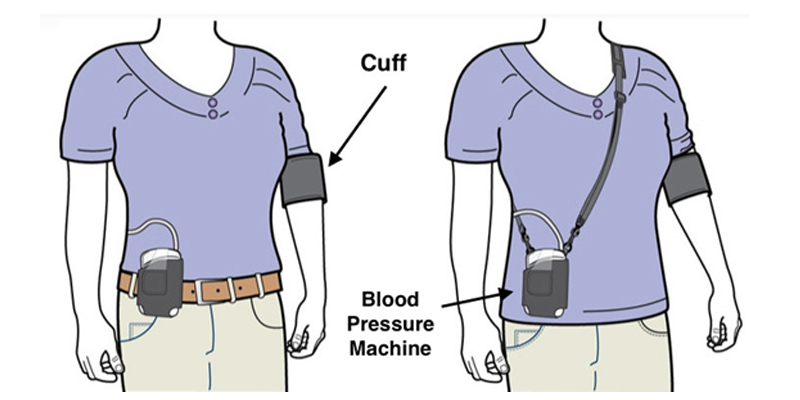 24-Hour Ambulatory Blood Pressure Monitoring ABPM in Hyderabad