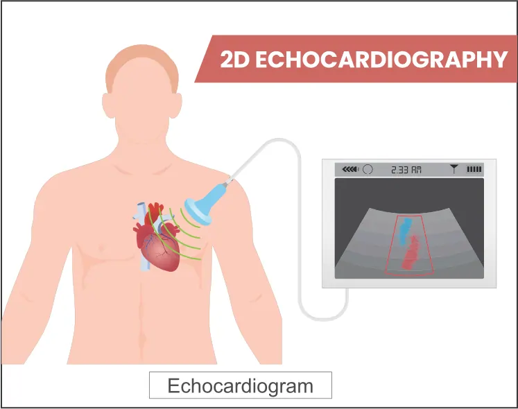 2D echocardiography service for adults, children and newborns in Hyderabad