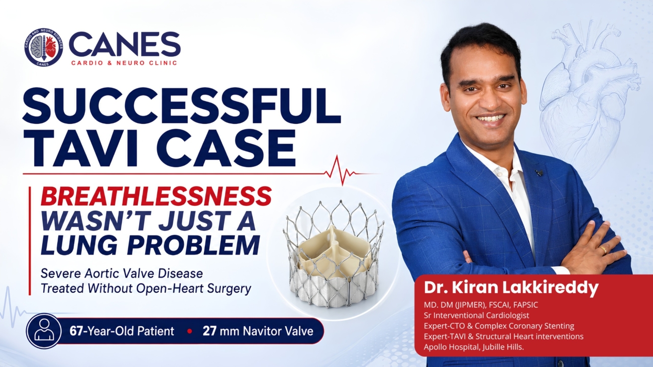 Crucial Guide: Successful TAVI Procedure for Valve Disease