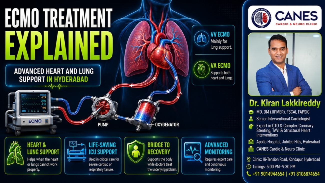 ECMO life support - Dr Kiran Lakkireddy Cardiologist Hyderabad