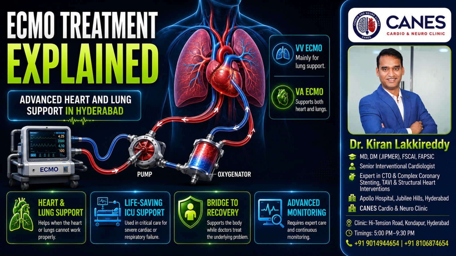 ECMO life support