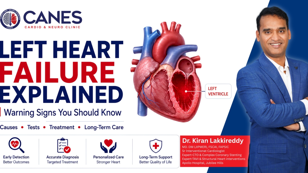 Left heart failure