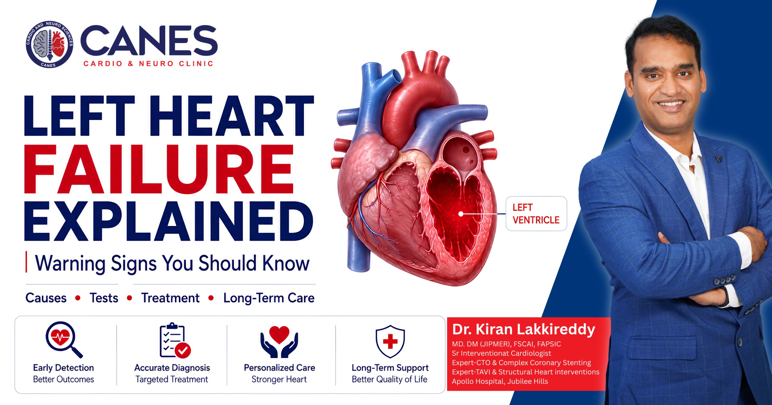 Left heart failure