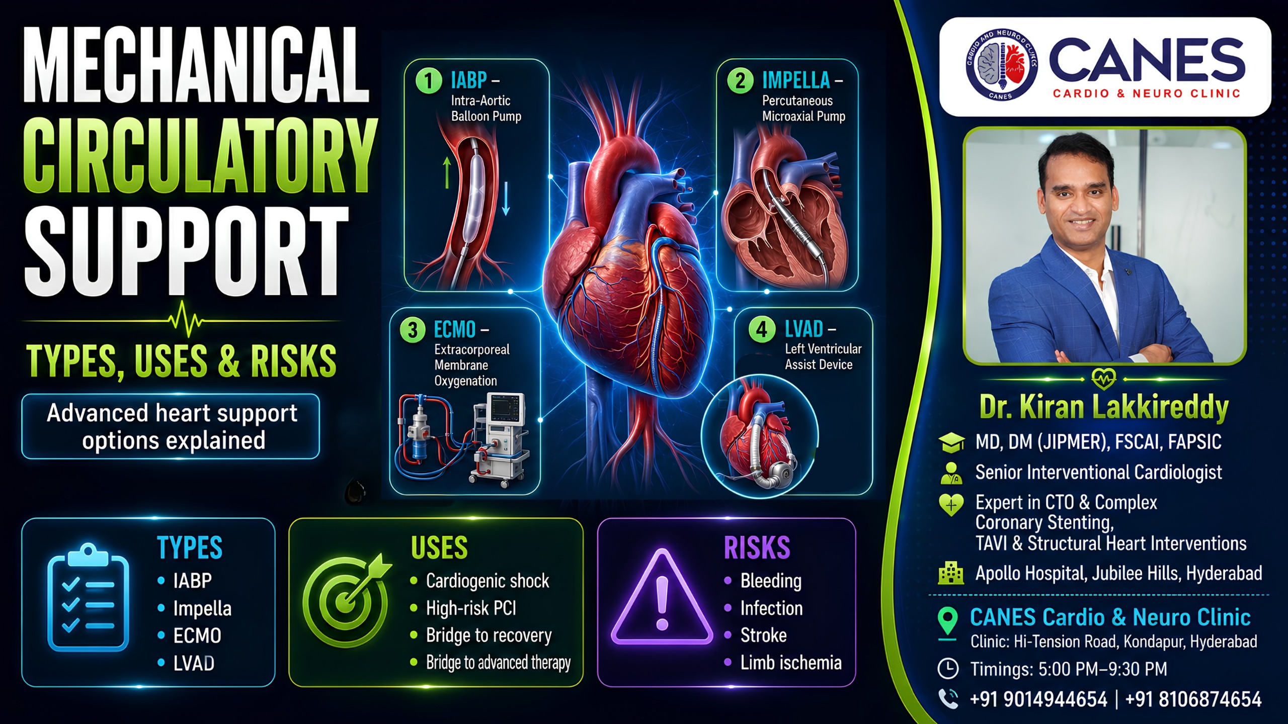 Mechanical circulatory support - Dr Kiran Lakkireddy Cardiologist Hyderabad