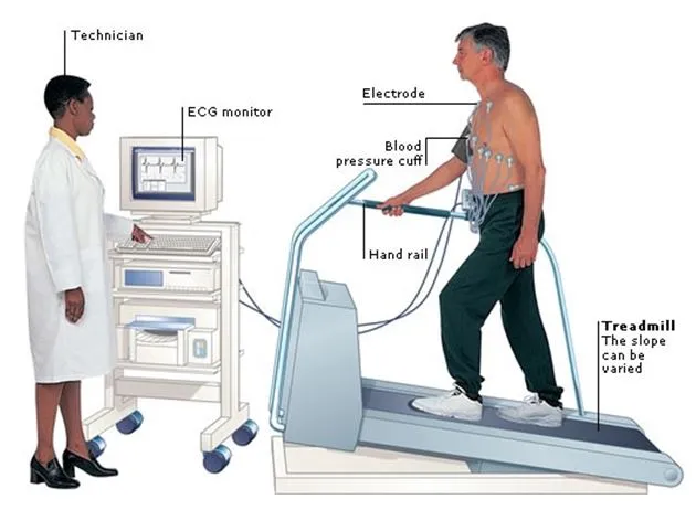 Treadmill Stress Test TMT in Hyderabad