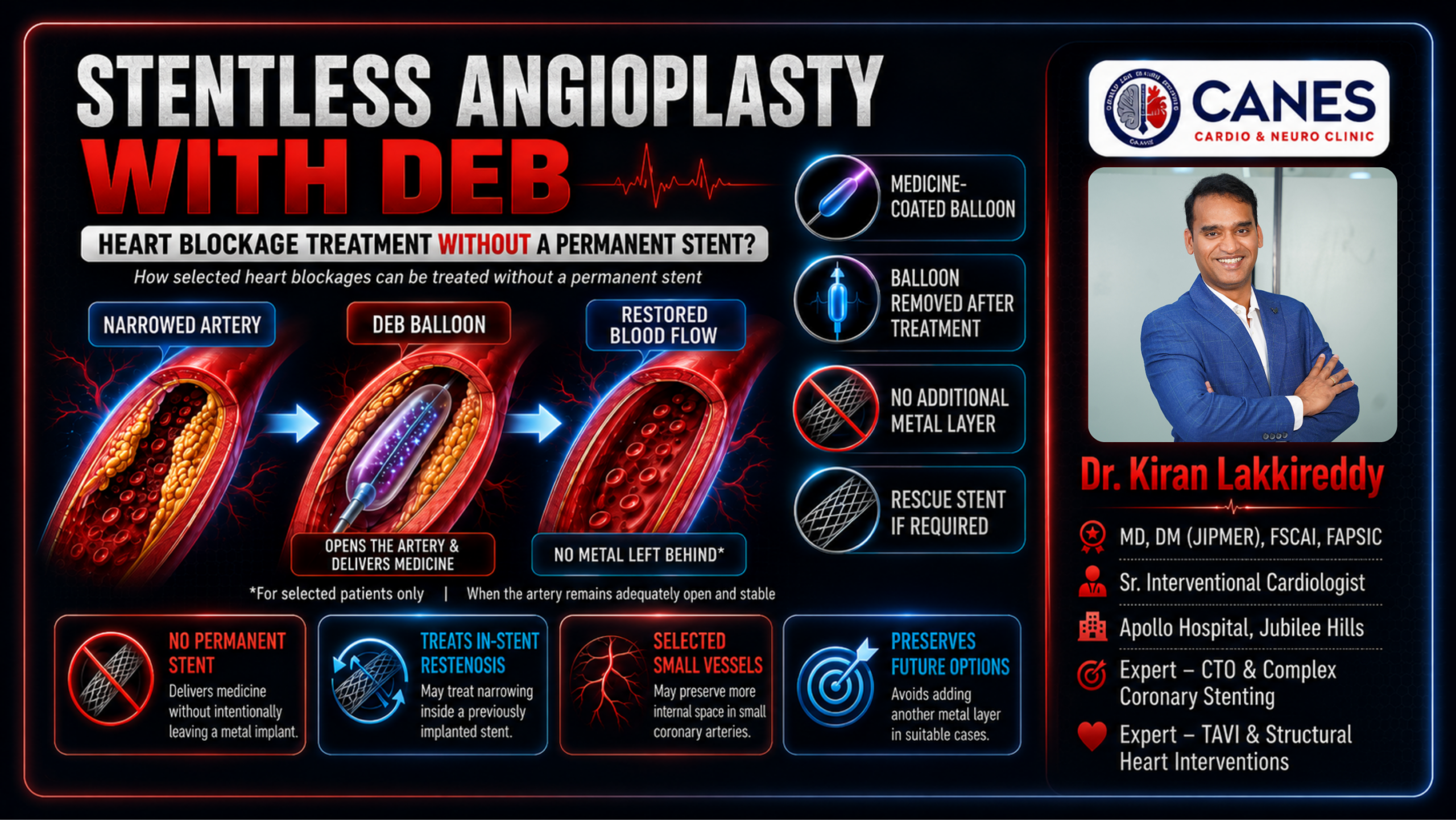 CANES Cardio & Neuro Clinic Dr. Kiran Lakkireddy MD, DM (JIPMER), FSCAI, FAPSIC Senior Interventional Cardiologist