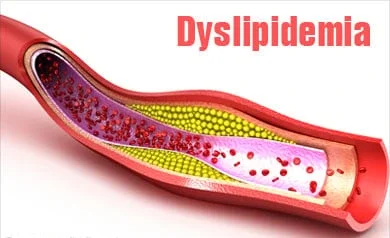 Dyslipidemia Treatment in Hyderabad | Cholesterol Care