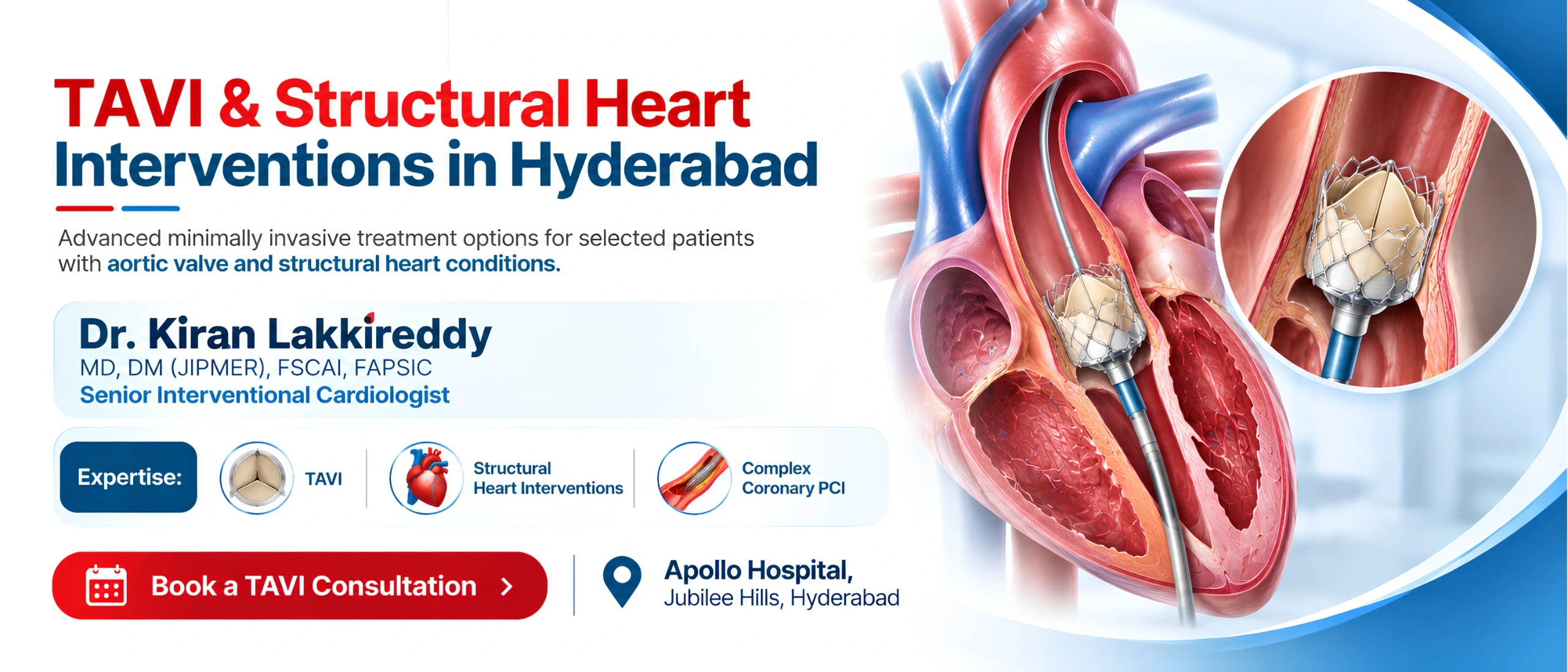 TAVI in Hyderabad | Dr. Kiran Lakkireddy – TAVI Specialist