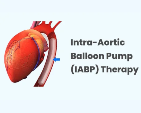 IABP