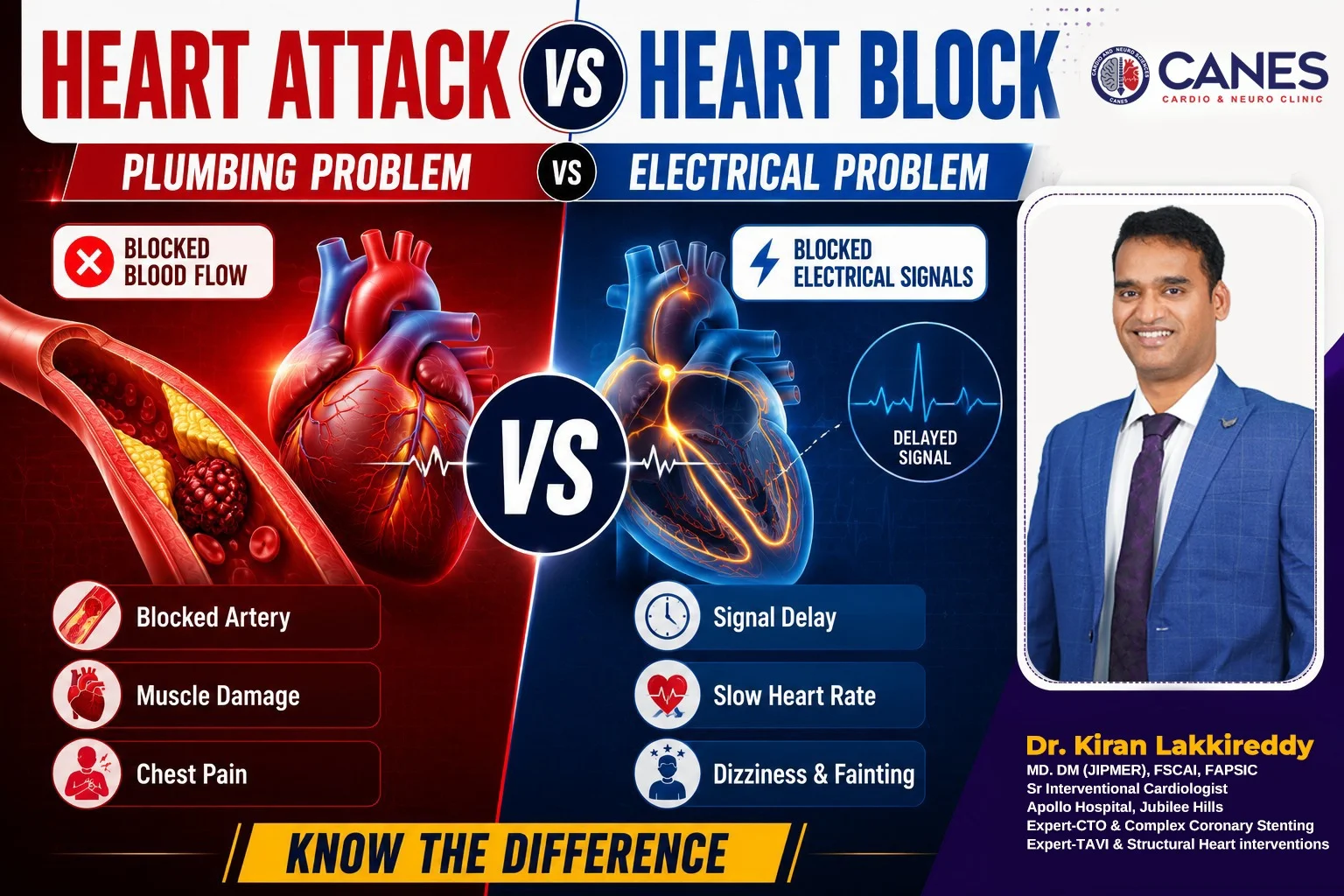 Difference Between a Heart Attack and Heart Block
