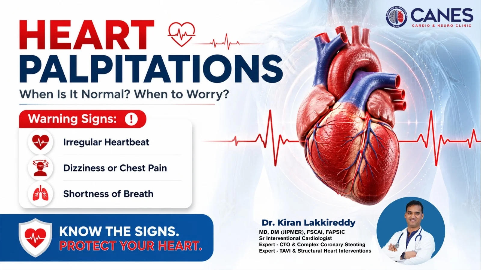 Heart Palpitations - Dr Kiran Lakkireddy - CANES Clinic