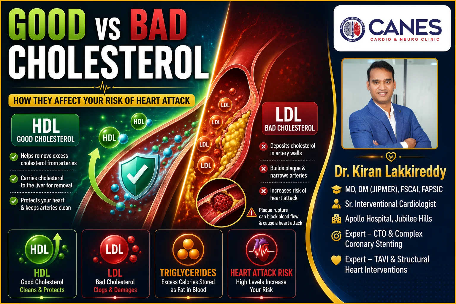 Good and bad cholesterol